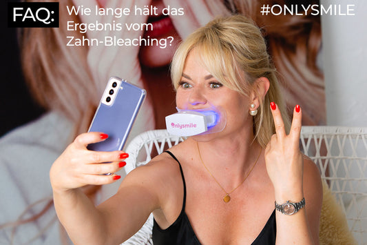 Wie lange hält das Ergebnis vom Zahn-Bleaching?